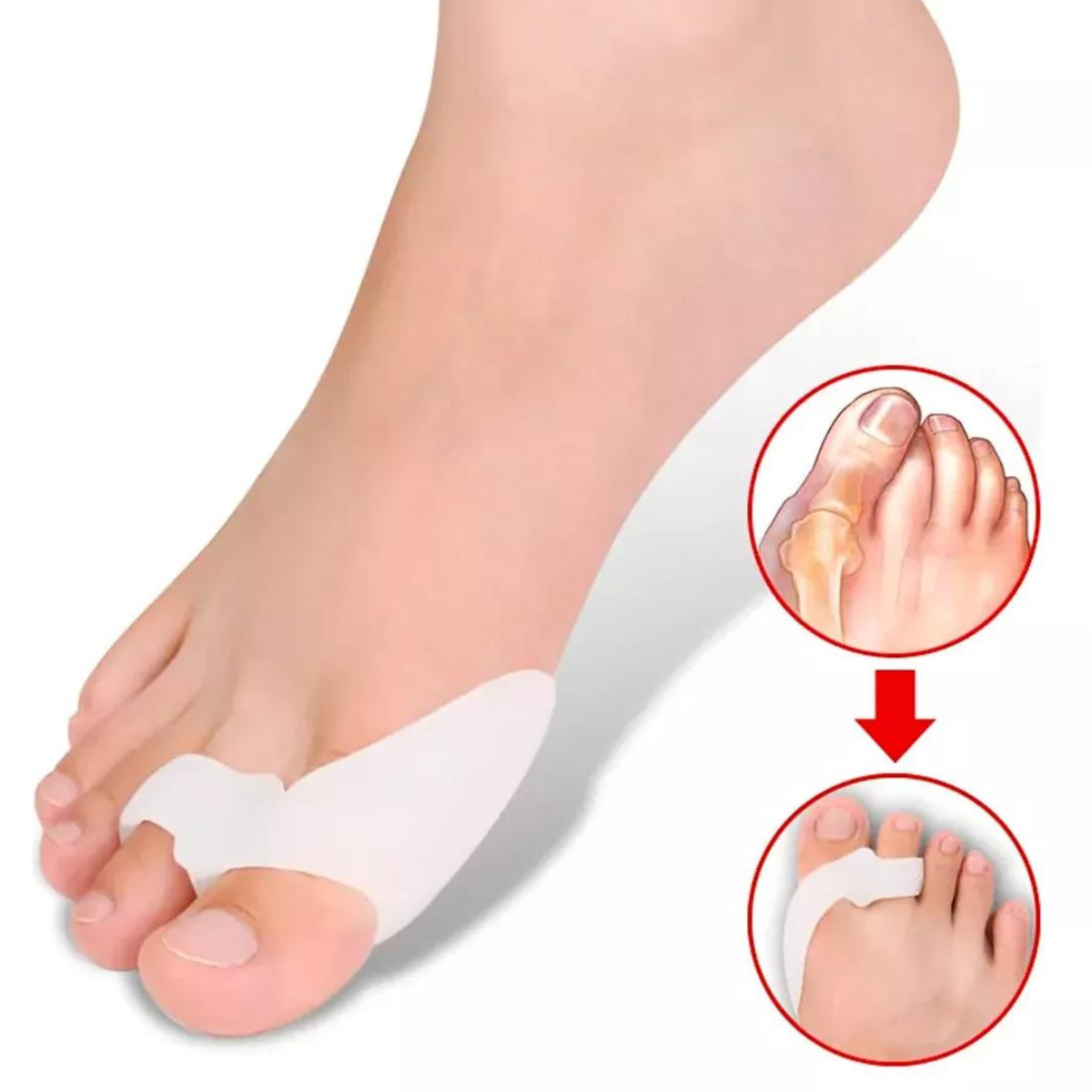 1 Par Protector Correctivo Ortopédico Silicona